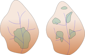 Differences in "patch" densities